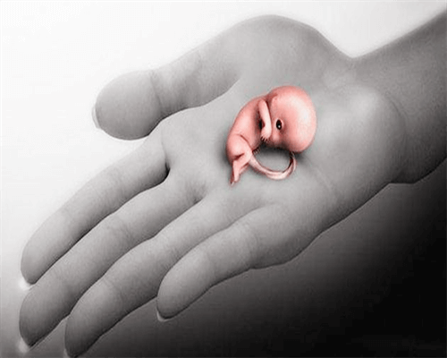 优贝助孕(坤和正规代孕机构),
              妊娠糖尿病会不会引发巨大儿和胎儿畸